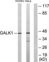 GALK1 Polyclonal Antibody