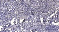 GALK1 Polyclonal Antibody