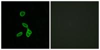 GALR1 Polyclonal Antibody
