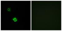 GALR3 Polyclonal Antibody