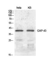GAP-43 Polyclonal Antibody