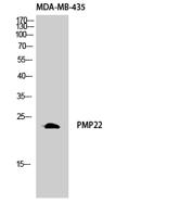 GAS3 Polyclonal Antibody