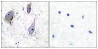 GAS3 Polyclonal Antibody