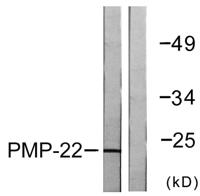GAS3 Polyclonal Antibody
