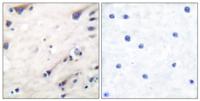Ksr-1 Polyclonal Antibody