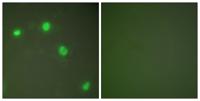 Ku-70 Polyclonal Antibody