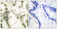Ku-70 Polyclonal Antibody