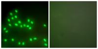 Ku-80 Polyclonal Antibody