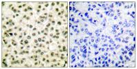 Ku-80 Polyclonal Antibody