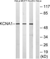 KV1.1 Polyclonal Antibody