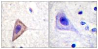 Kv1.3 Polyclonal Antibody