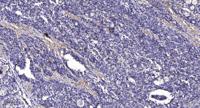 KV1.5 Polyclonal Antibody