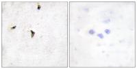 Kv2.1 Polyclonal Antibody