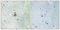 KV3.1 Polyclonal Antibody