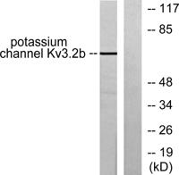 KV3.2 Polyclonal Antibody
