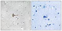 Kv4.2 Polyclonal Antibody