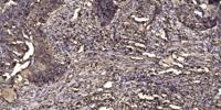KV8.2 Polyclonal Antibody
