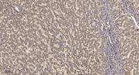 KV9.2 Polyclonal Antibody