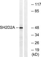 Lad Polyclonal Antibody