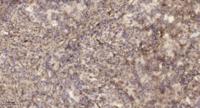Lad Polyclonal Antibody