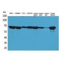 Lamin B1 Polyclonal Antibody