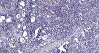 Laminin α-1 Polyclonal Antibody