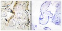 Laminin α-2 Polyclonal Antibody