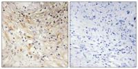 Laminin β-3 Polyclonal Antibody