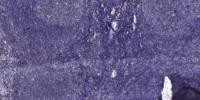 Laminin γ-1 Polyclonal Antibody
