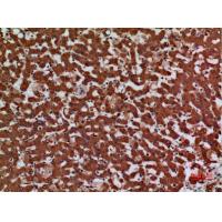 Laminin γ-2 Polyclonal Antibody