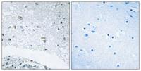 Laminin γ-3 Polyclonal Antibody