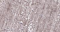 CNOT2 Polyclonal Antibody