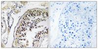 CNOT4 Polyclonal Antibody