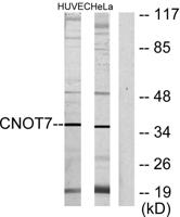 CNOT7 Polyclonal Antibody