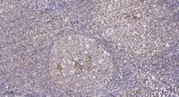 CNOT7 Polyclonal Antibody