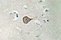 CNPase Polyclonal Antibody