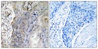 CNT2 Polyclonal Antibody