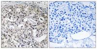 CNTD2 Polyclonal Antibody