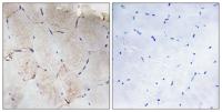 COL12A1 Polyclonal Antibody