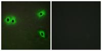 COL13A1 Polyclonal Antibody