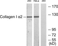 COL1A2 Polyclonal Antibody