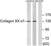 COL20A1 Polyclonal Antibody