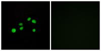 COL23A1 Polyclonal Antibody