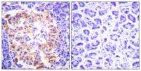 COL3A1 Polyclonal Antibody