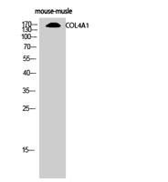 COL4A1 Polyclonal Antibody