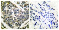 COL4A1 Polyclonal Antibody