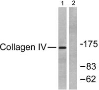 COL4A1 Polyclonal Antibody