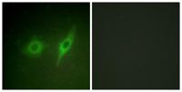 COL4A2 Polyclonal Antibody
