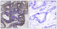 COL4A2 Polyclonal Antibody