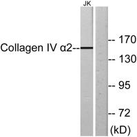 COL4A2 Polyclonal Antibody